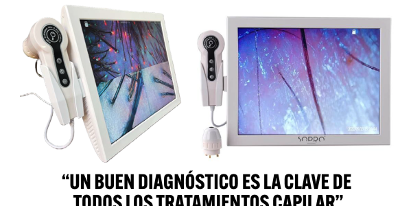 CÁMARA DE DIAGNÓSTICO CAPILAR